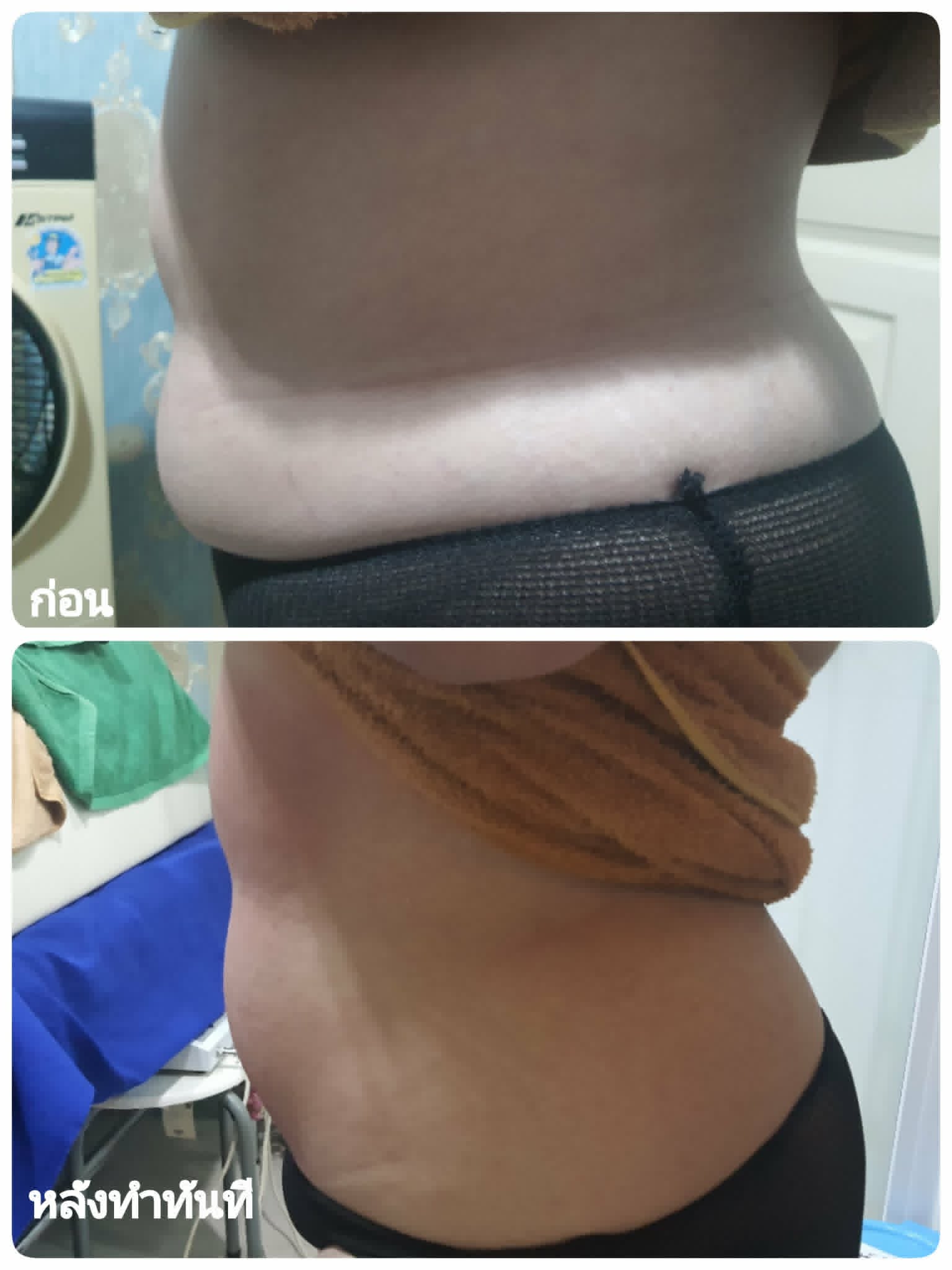 Before & After 1