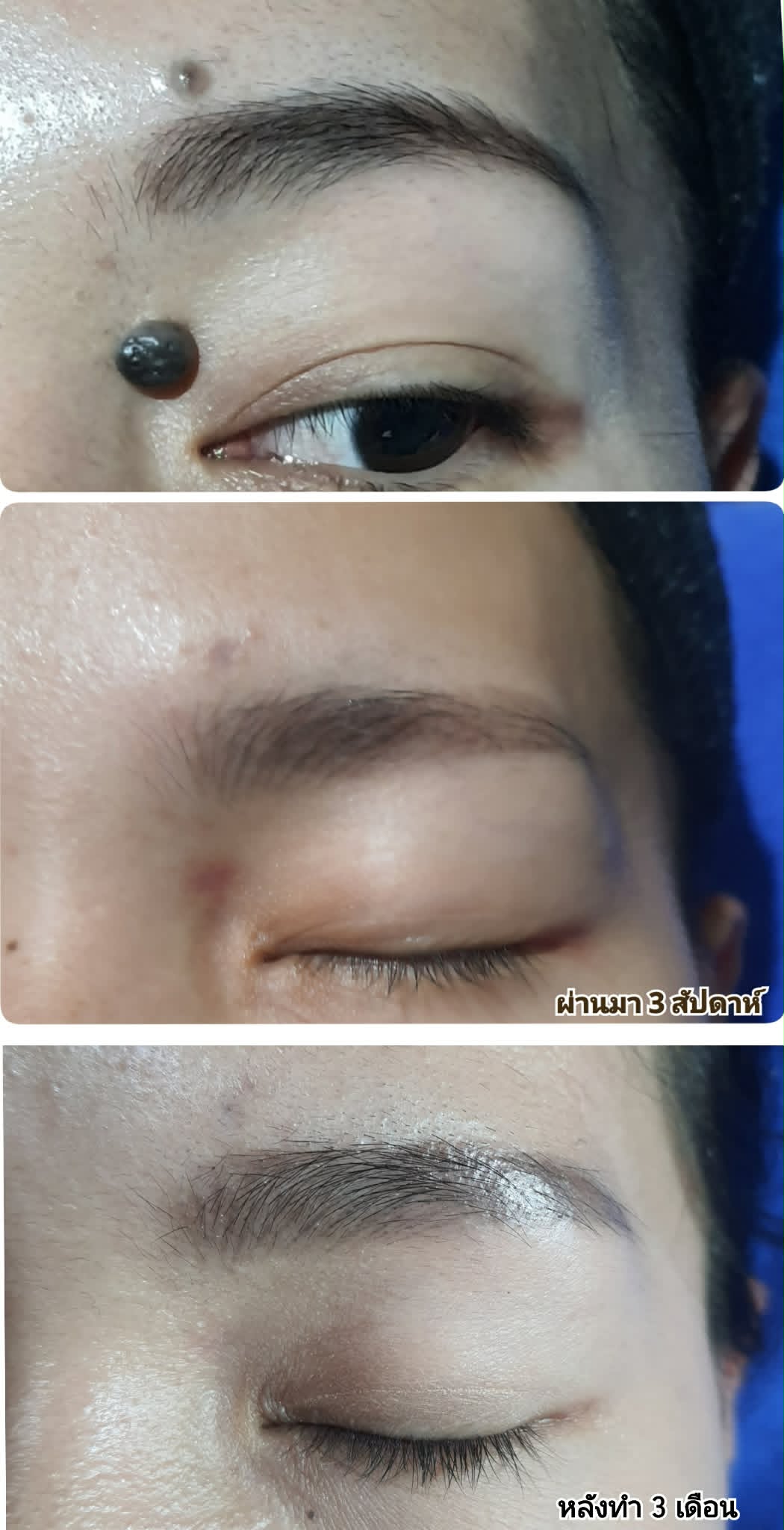 Before & After 5