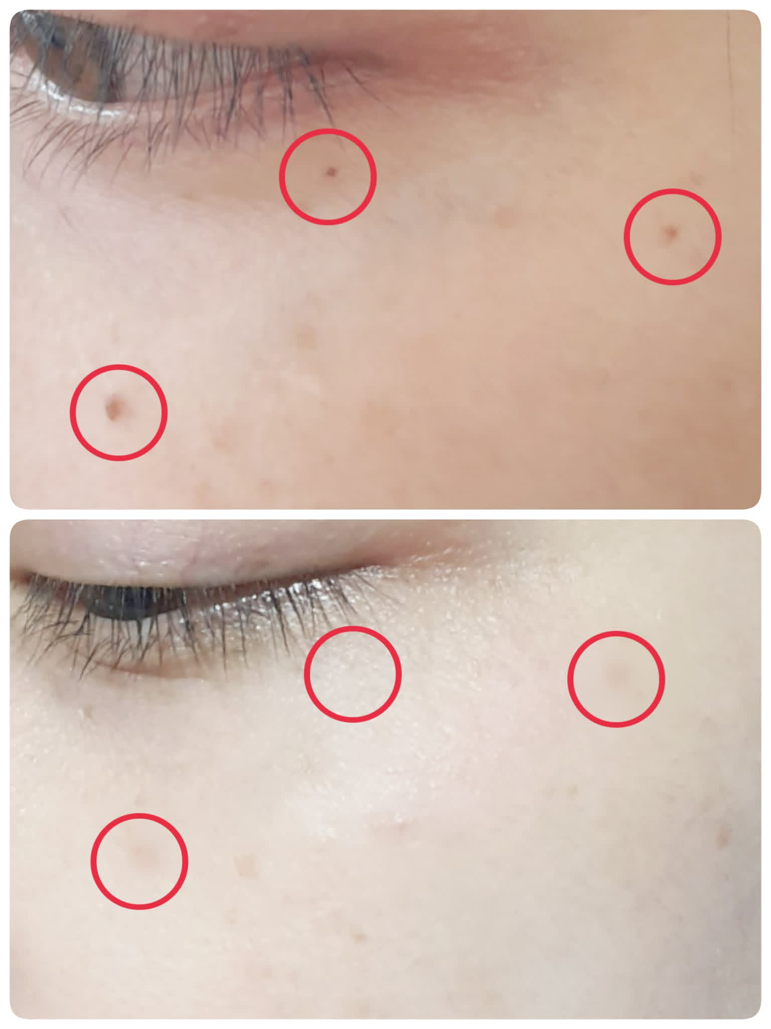 Before & After 7